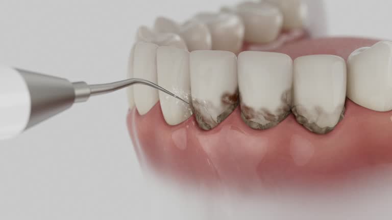 Reliable Dental Implants contractor in DeCordova, TX by Smile Center Dentistry
